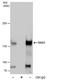 Desmoglein 3 antibody, PA5-77949, Invitrogen Antibodies, Immunoprecipitation image 