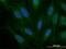 Snail Family Transcriptional Repressor 2 antibody, H00006591-M05, Novus Biologicals, Immunofluorescence image 