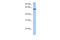 Tripartite Motif Containing 22 antibody, 27-251, ProSci, Enzyme Linked Immunosorbent Assay image 