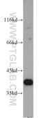 Transmembrane Protein 173 antibody, 19851-1-AP, Proteintech Group, Western Blot image 