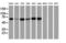 Insulin Like Growth Factor 2 MRNA Binding Protein 2 antibody, LS-C172313, Lifespan Biosciences, Western Blot image 