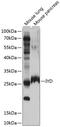 Iodotyrosine Deiodinase antibody, 23-810, ProSci, Western Blot image 