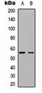 Potassium Voltage-Gated Channel Subfamily A Member 1 antibody, orb334755, Biorbyt, Western Blot image 