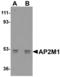 AP2M1 antibody, A06179-1, Boster Biological Technology, Western Blot image 