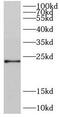 DIRAS Family GTPase 2 antibody, FNab02393, FineTest, Western Blot image 