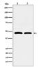 Farnesyl-Diphosphate Farnesyltransferase 1 antibody, M05118, Boster Biological Technology, Western Blot image 