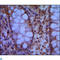 Structural Maintenance Of Chromosomes 1A antibody, LS-C812775, Lifespan Biosciences, Immunohistochemistry paraffin image 