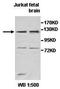 Tankyrase 2 antibody, orb77543, Biorbyt, Western Blot image 