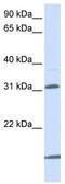 Solute Carrier Family 25 Member 11 antibody, TA333993, Origene, Western Blot image 