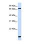 Acyl-CoA Synthetase Long Chain Family Member 4 antibody, NBP1-69303, Novus Biologicals, Western Blot image 