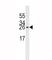 Eukaryotic Translation Initiation Factor 4E antibody, F53514-0.1ML, NSJ Bioreagents, Western Blot image 