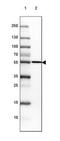 Cytochrome P450 Family 21 Subfamily A Member 2 antibody, NBP2-38698, Novus Biologicals, Western Blot image 