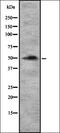 Glycoprotein Ib Platelet Subunit Alpha antibody, orb337316, Biorbyt, Western Blot image 
