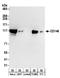 Melanoma Cell Adhesion Molecule antibody, A304-336A, Bethyl Labs, Western Blot image 