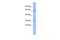 Histidine Rich Glycoprotein antibody, GTX47165, GeneTex, Western Blot image 