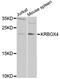 KRAB Box Domain Containing 4 antibody, STJ28554, St John