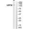 Ubiquitin Specific Peptidase 38 antibody, A13191, Boster Biological Technology, Western Blot image 