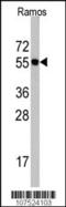 Cell Division Cycle 6 antibody, 62-209, ProSci, Western Blot image 
