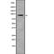 Ankyrin Repeat Domain 20 Family Member A3 antibody, PA5-67637, Invitrogen Antibodies, Western Blot image 