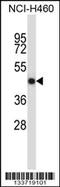 Osteoprotegerin antibody, 57-236, ProSci, Western Blot image 