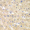 Acyl-CoA Dehydrogenase Short Chain antibody, 13-328, ProSci, Immunohistochemistry paraffin image 