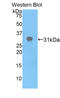 Apoptotic Peptidase Activating Factor 1 antibody, LS-C292923, Lifespan Biosciences, Western Blot image 