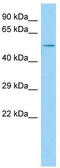 G Protein Regulated Inducer Of Neurite Outgrowth 2 antibody, TA334307, Origene, Western Blot image 