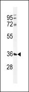 Transmembrane and coiled-coil domain-containing protein 5B antibody, PA5-71528, Invitrogen Antibodies, Western Blot image 