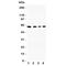 Cell adhesion molecule 1 antibody, R31418, NSJ Bioreagents, Western Blot image 