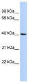 Immediate-early protein CL-6 antibody, TA345659, Origene, Western Blot image 