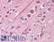 Tubulin antibody, LS-C142444, Lifespan Biosciences, Immunohistochemistry paraffin image 