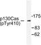 BCAR1 Scaffold Protein, Cas Family Member antibody, LS-C192181, Lifespan Biosciences, Western Blot image 