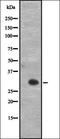 Adenylate Cyclase 8 antibody, orb335104, Biorbyt, Western Blot image 