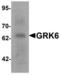 G Protein-Coupled Receptor Kinase 6 antibody, LS-B10182, Lifespan Biosciences, Western Blot image 