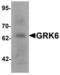 G protein-coupled receptor kinase 6 antibody, LS-B10182, Lifespan Biosciences, Western Blot image 