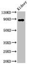 Dipeptidyl Peptidase 4 antibody, CSB-PA06229A0Rb, Cusabio, Western Blot image 