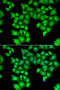 Integrator Complex Subunit 11 antibody, STJ28649, St John