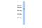 Preferentially Expressed Antigen In Melanoma antibody, GTX45143, GeneTex, Western Blot image 