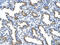Polymorphic epithelial mucin antibody, ARP41446_T100, Aviva Systems Biology, Immunohistochemistry frozen image 