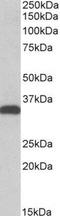 Carbonyl Reductase 3 antibody, NB300-858, Novus Biologicals, Western Blot image 