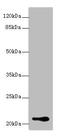 RB Binding Protein 9, Serine Hydrolase antibody, A60538-100, Epigentek, Western Blot image 