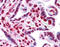 High Mobility Group Box 1 antibody, 51-467, ProSci, Immunohistochemistry paraffin image 