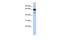 Deleted In Azoospermia 1 antibody, PA5-44927, Invitrogen Antibodies, Western Blot image 