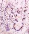 Tumor Protein P63 antibody, orb389279, Biorbyt, Immunohistochemistry paraffin image 
