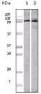 EPH Receptor A1 antibody, MA5-15271, Invitrogen Antibodies, Western Blot image 