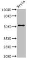 Ankyrin Repeat, SAM And Basic Leucine Zipper Domain Containing 1 antibody, LS-C397557, Lifespan Biosciences, Western Blot image 