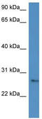 Mcpt5 antibody, TA342809, Origene, Western Blot image 