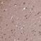 ACOT6 antibody, PA5-63541, Invitrogen Antibodies, Immunohistochemistry paraffin image 