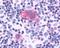C-X-C Motif Chemokine Receptor 1 antibody, NLS806, Novus Biologicals, Immunohistochemistry frozen image 