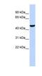 Prostaglandin I2 Synthase antibody, NBP1-62390, Novus Biologicals, Western Blot image 